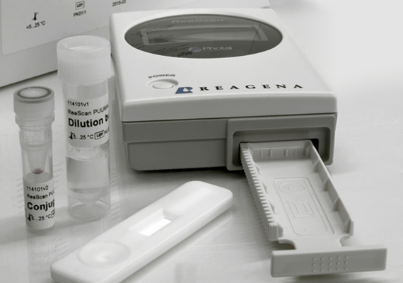 Diagnostika TBE a borreliózy